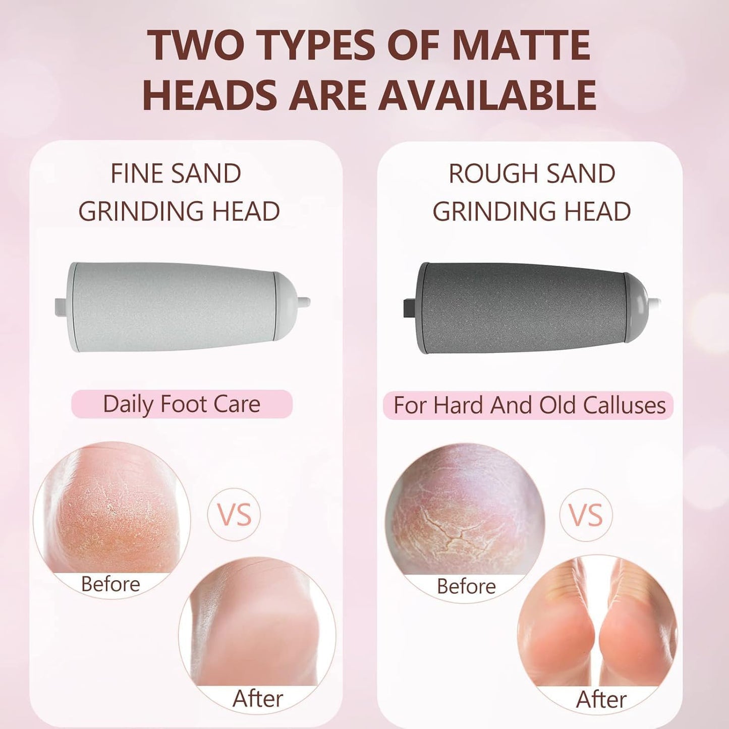 Electric Foot File and Callus Remover